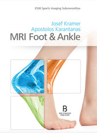 Vorderes Coverbild MRI Foot & Ankle