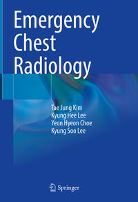 Vorderes Coverbild Emergency Chest Radiology