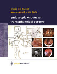 Vorderes Coverbild Endoscopic Endonasal Transsphenoidal Surgery