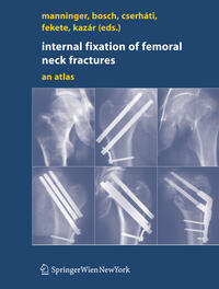 Vorderes Coverbild Internal fixation of femoral neck fractures