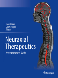 Vorderes Coverbild Neuraxial Therapeutics