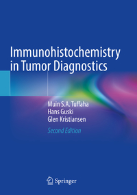 Vorderes Coverbild Immunohistochemistry in Tumor Diagnostics