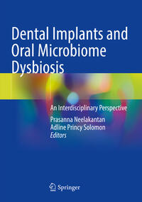 Vorderes Coverbild Dental Implants and Oral Microbiome Dysbiosis