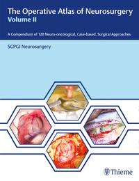 Vorderes Coverbild The Operative Atlas of Neurosurgery, Vol II