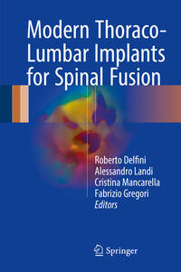 Vorderes Coverbild Modern Thoraco-Lumbar Implants for Spinal Fusion