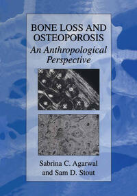 Vorderes Coverbild Bone Loss and Osteoporosis