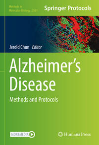 Vorderes Coverbild Alzheimer’s Disease