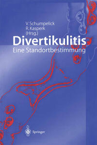 Vorderes Coverbild Divertikulitis