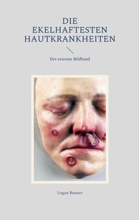 Vorderes Coverbild Die ekelhaftesten Hautkrankheiten