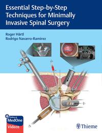 Vorderes Coverbild Essential Step-by-Step Techniques for Minimally Invasive Spinal Surgery