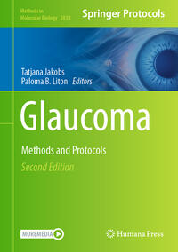 Vorderes Coverbild Glaucoma