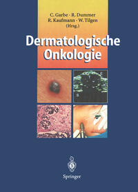 Vorderes Coverbild Dermatologische Onkologie
