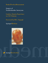 Vorderes Coverbild Surgery of Vertebrobasilar Aneurysms