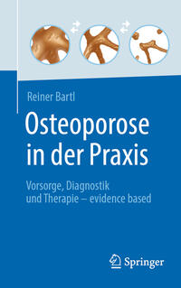 Vorderes Coverbild Osteoporose in der Praxis