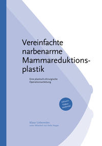 Vorderes Coverbild Vereinfachte Narbenarme Mammareduktionsplastik