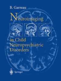 Vorderes Coverbild Neuroimaging in child neuropsychiatric disorders