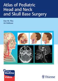 Vorderes Coverbild Atlas of Pediatric Head and Neck and Skull Base Surgery