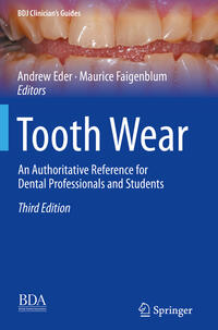 Vorderes Coverbild Tooth Wear