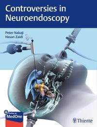 Vorderes Coverbild Controversies in Neuroendoscopy