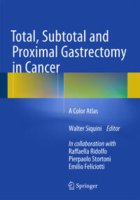 Vorderes Coverbild Total, Subtotal and Proximal Gastrectomy in Cancer