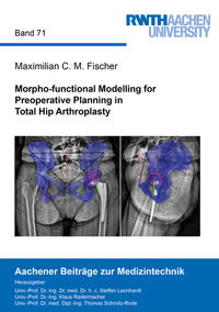 Vorderes Coverbild Morpho-functional Modelling for Preoperative Planning in Total Hip Arthroplasty