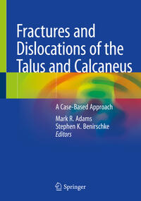 Vorderes Coverbild Fractures and Dislocations of the Talus and Calcaneus