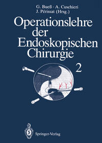 Vorderes Coverbild Operationslehre der Endoskopischen Chirurgie