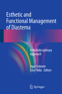 Vorderes Coverbild Esthetic and Functional Management of Diastema