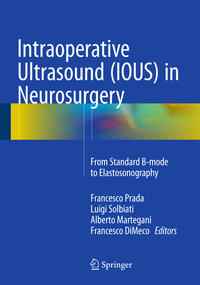 Vorderes Coverbild Intraoperative Ultrasound (IOUS) in Neurosurgery