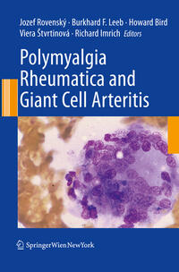 Vorderes Coverbild Polymyalgia Rheumatica and Giant Cell Arteritis