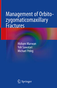 Vorderes Coverbild Management of Orbito-zygomaticomaxillary Fractures