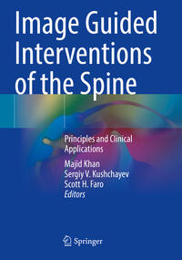Vorderes Coverbild Image Guided Interventions of the Spine
