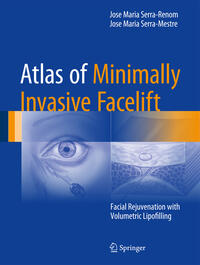 Vorderes Coverbild Atlas of Minimally Invasive Facelift