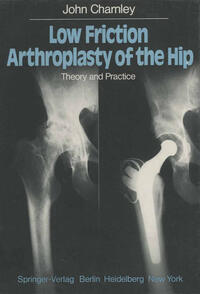 Vorderes Coverbild Low Friction Arthroplasty of the Hip