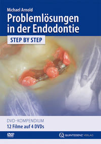 Vorderes Coverbild Problemlösungen in der Endodontie