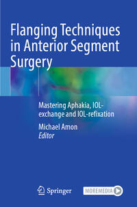 Vorderes Coverbild Flanging Techniques in Anterior Segment Surgery