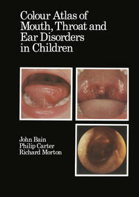 Vorderes Coverbild Colour Atlas of Mouth, Throat and Ear Disorders in Children