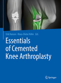 Vorderes Coverbild Essentials of Cemented Knee Arthroplasty