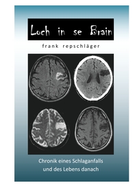 Vorderes Coverbild Loch in se Brain