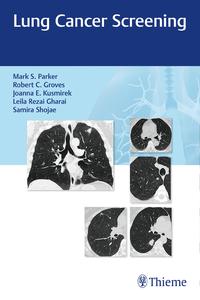 Vorderes Coverbild Lung Cancer Screening