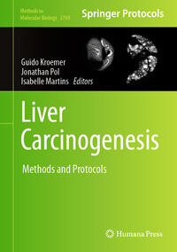 Vorderes Coverbild Liver Carcinogenesis
