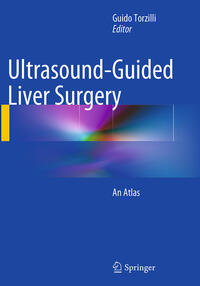 Vorderes Coverbild Ultrasound-Guided Liver Surgery