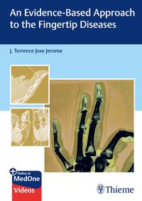 Vorderes Coverbild An Evidence-Based Approach to the Fingertip Diseases