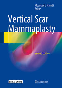 Vorderes Coverbild Vertical Scar Mammaplasty