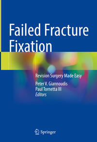 Vorderes Coverbild Failed Fracture Fixation