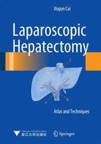 Vorderes Coverbild Laparoscopic Hepatectomy