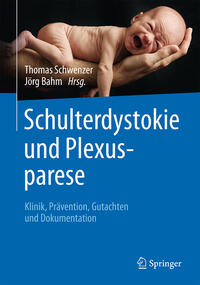 Vorderes Coverbild Schulterdystokie und Plexusparese