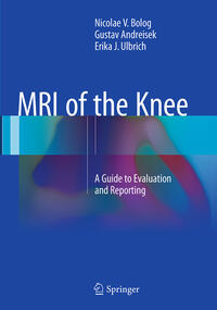 Vorderes Coverbild MRI of the Knee