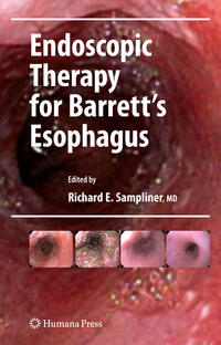 Vorderes Coverbild Endoscopic Therapy for Barrett's Esophagus