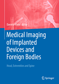 Vorderes Coverbild Medical Imaging of Implanted Devices and Foreign Bodies